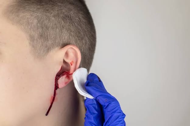 Ear Canal Injury and Irritation